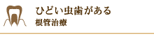 ひどい虫歯がある 根管治療