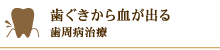 歯ぐきから血が出る 歯周病治療